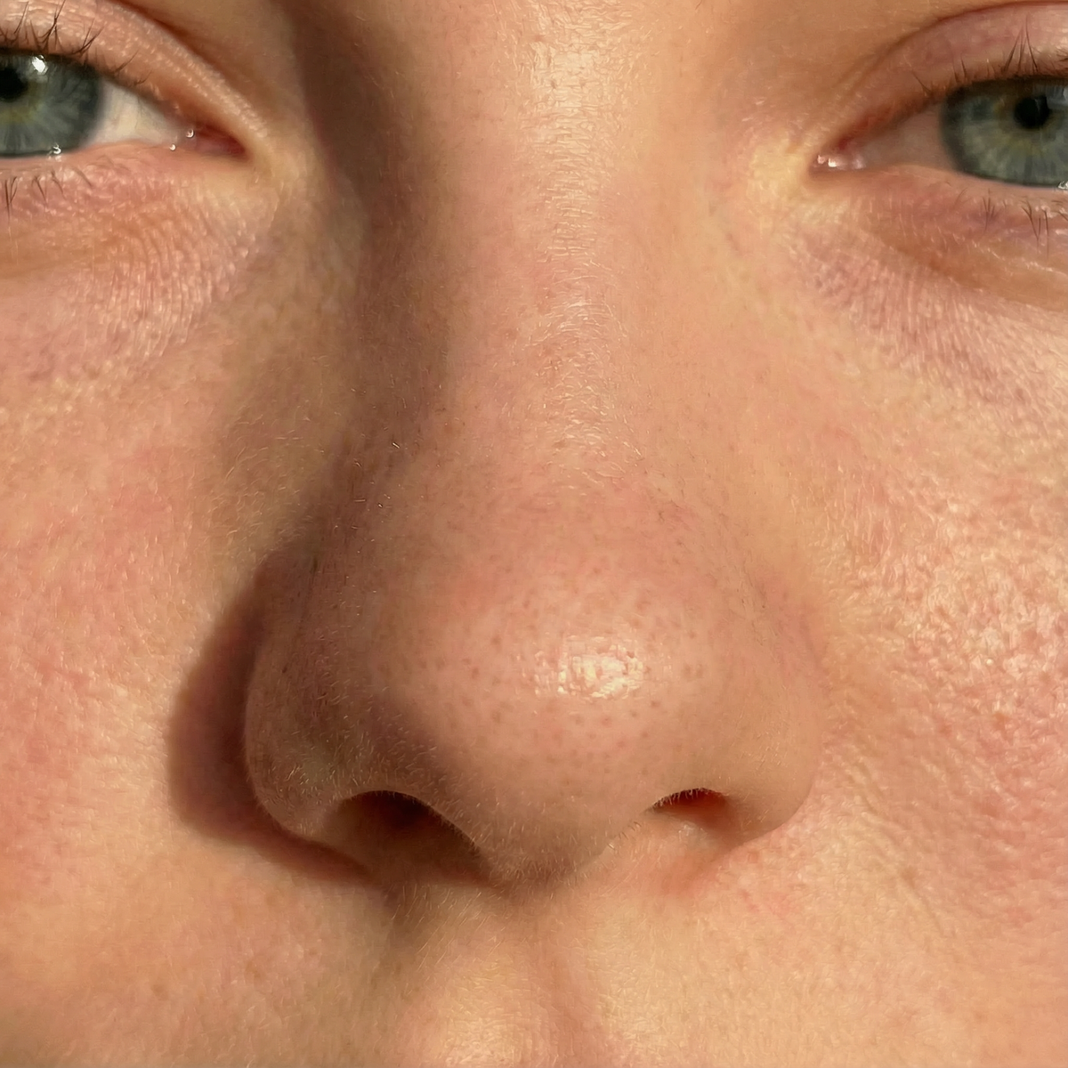 Before image for Freckles Pen with Natural Look