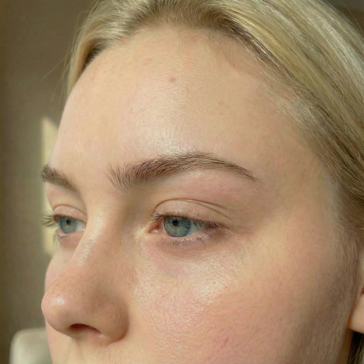 Before image for Sculpt & Lift Face Patches