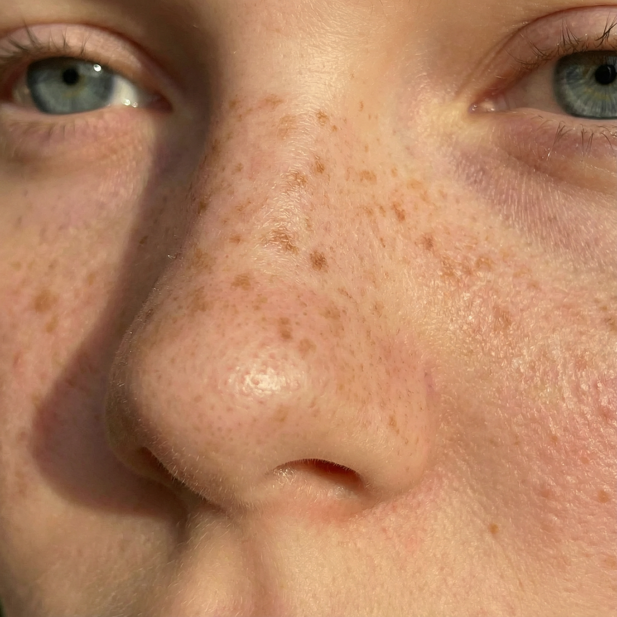 After image for Natural Freckles Pen